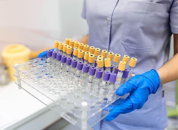 muestrasdisponibles_cienciaseinvestigacion_revista_in_Vitro_annar